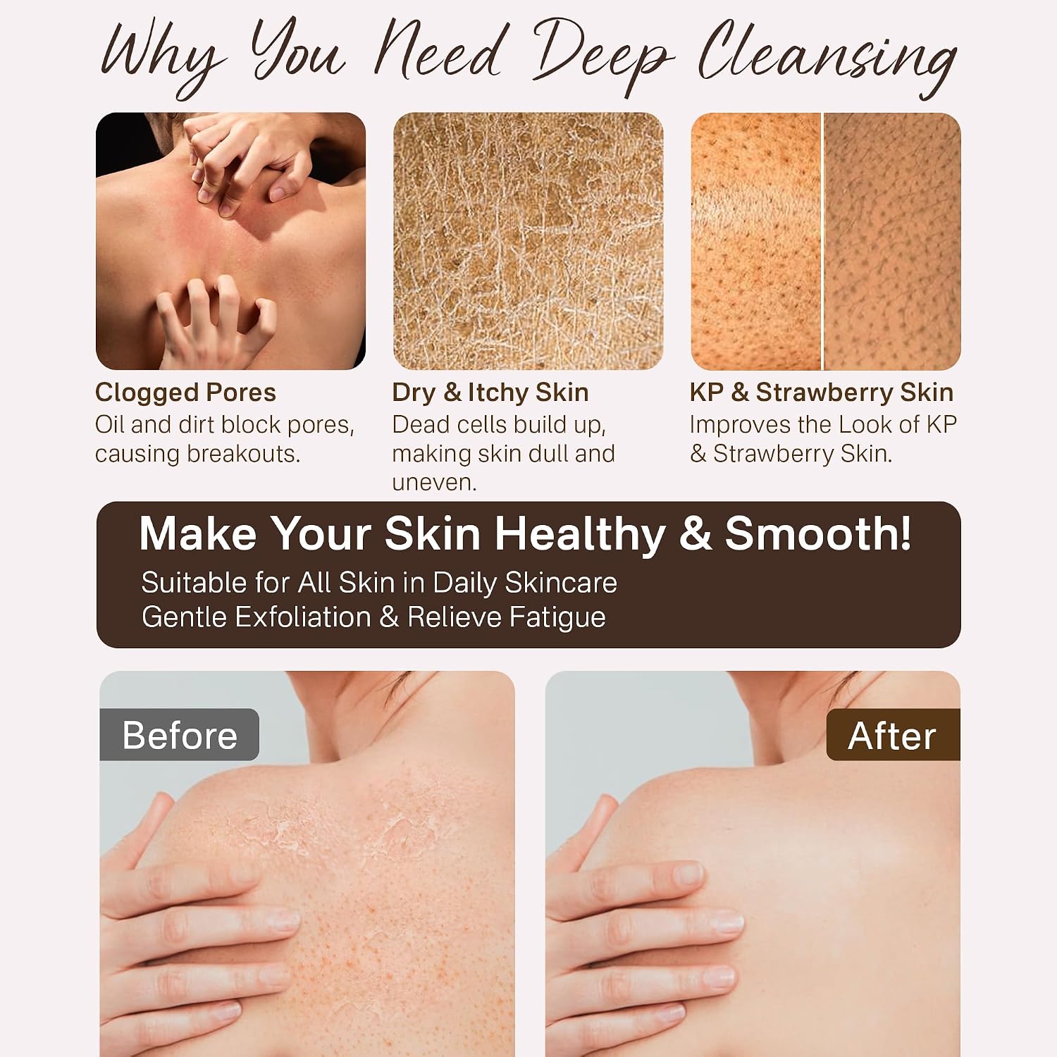 Exfoliating Gloves, Exfoliating Body Scrubber for Bath Shower Exfoliation, Body Scrub Exfoliator Loofah Sponge for Dead Skin Remover Brown+Black image 4
