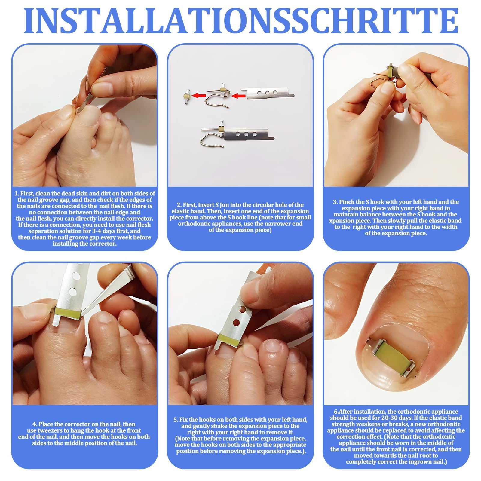 25 Piezas Set Correctores Para Uñas Encarnadas Corrector Uñas Encarnadas Fácil Aplicación Para Uso Doméstico Sujeción Segura Alivio Del Dolor (Longitud De La Uña Del Pie De 19 Mm a 21 Mm)