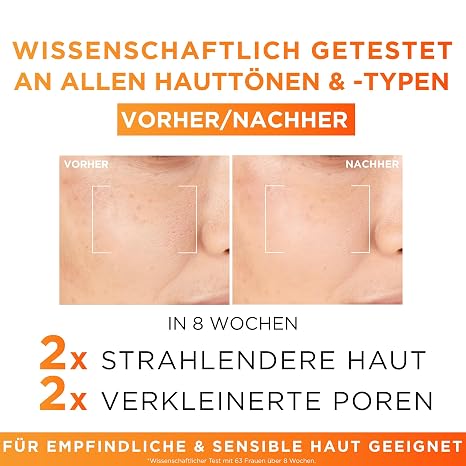 l'oréal paris pures 12% vitamin c serum for women: improved skin pattern with 12% pure vitamin c + vitamin e + salicylic acid revitalift clinical 1x 30ml