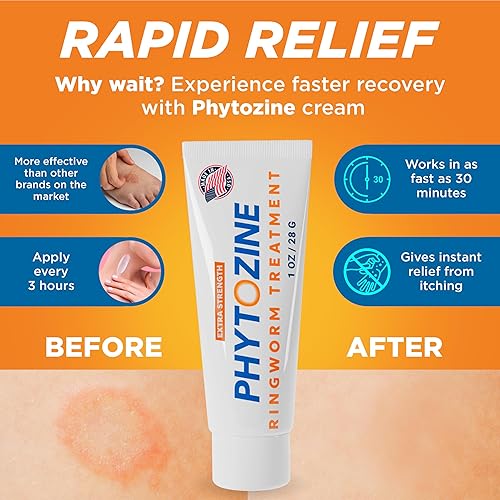 Miniatura 3 de Tratamiento antifúngico de tiña para humanos, potente crema antifúngica y tratamiento eficaz para pies de atleta para adultos y niños (2 onzas)