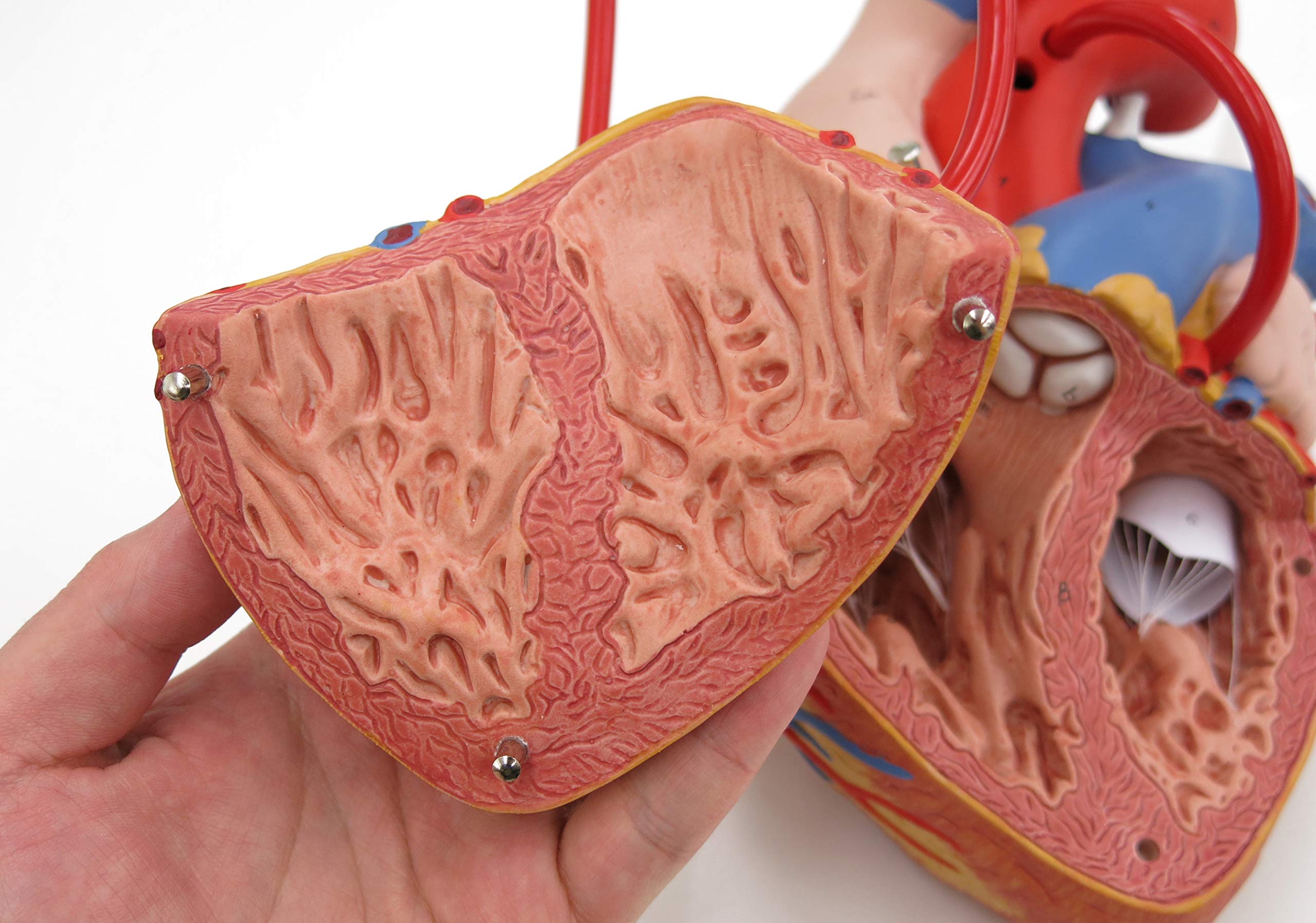 3B Scientific G06 Modello di Anatomia Umana Cuore con Bypass, Ingrandito 2 Volte, in 4 Parti + software gratuito di anatomia - 3B Smart Anatomy