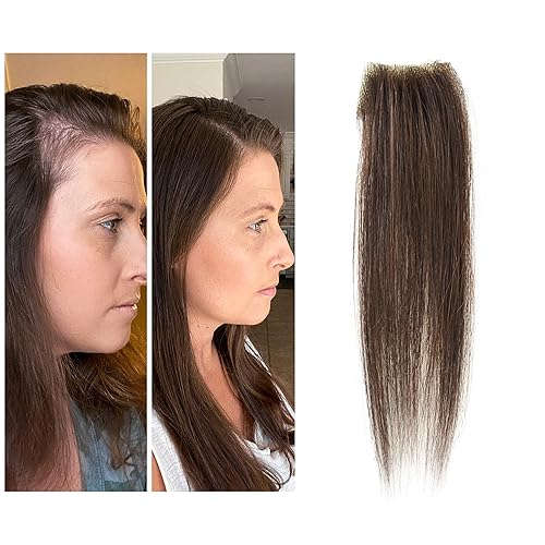 Reemplazo de cabello humano con cicatrices, quemaduras accidentales sin vello para hombres y mujeres, pérdida de línea de cabello, cinta recta de