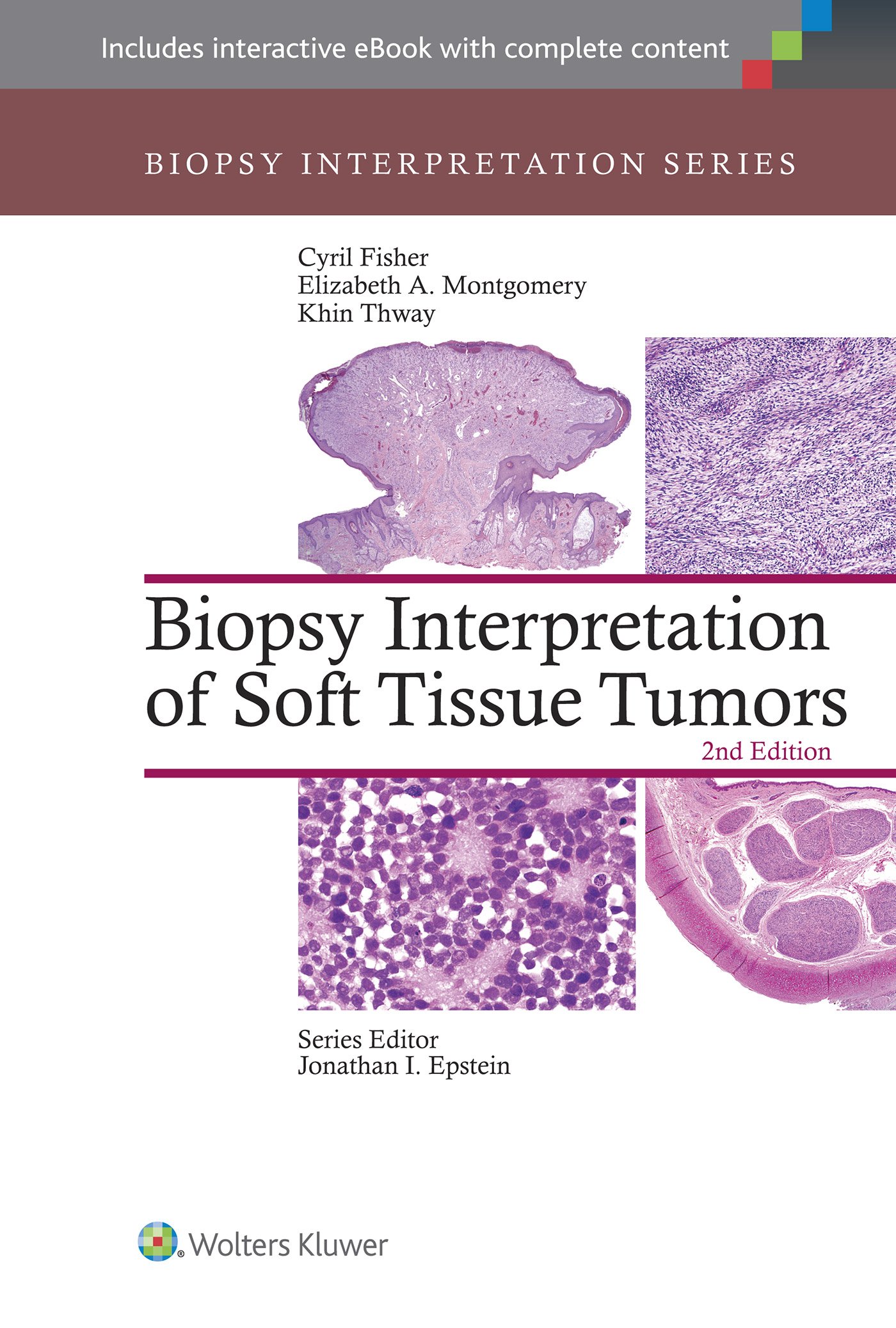 Snapklik.com : Biopsy Interpretation Of Soft Tissue Tumors