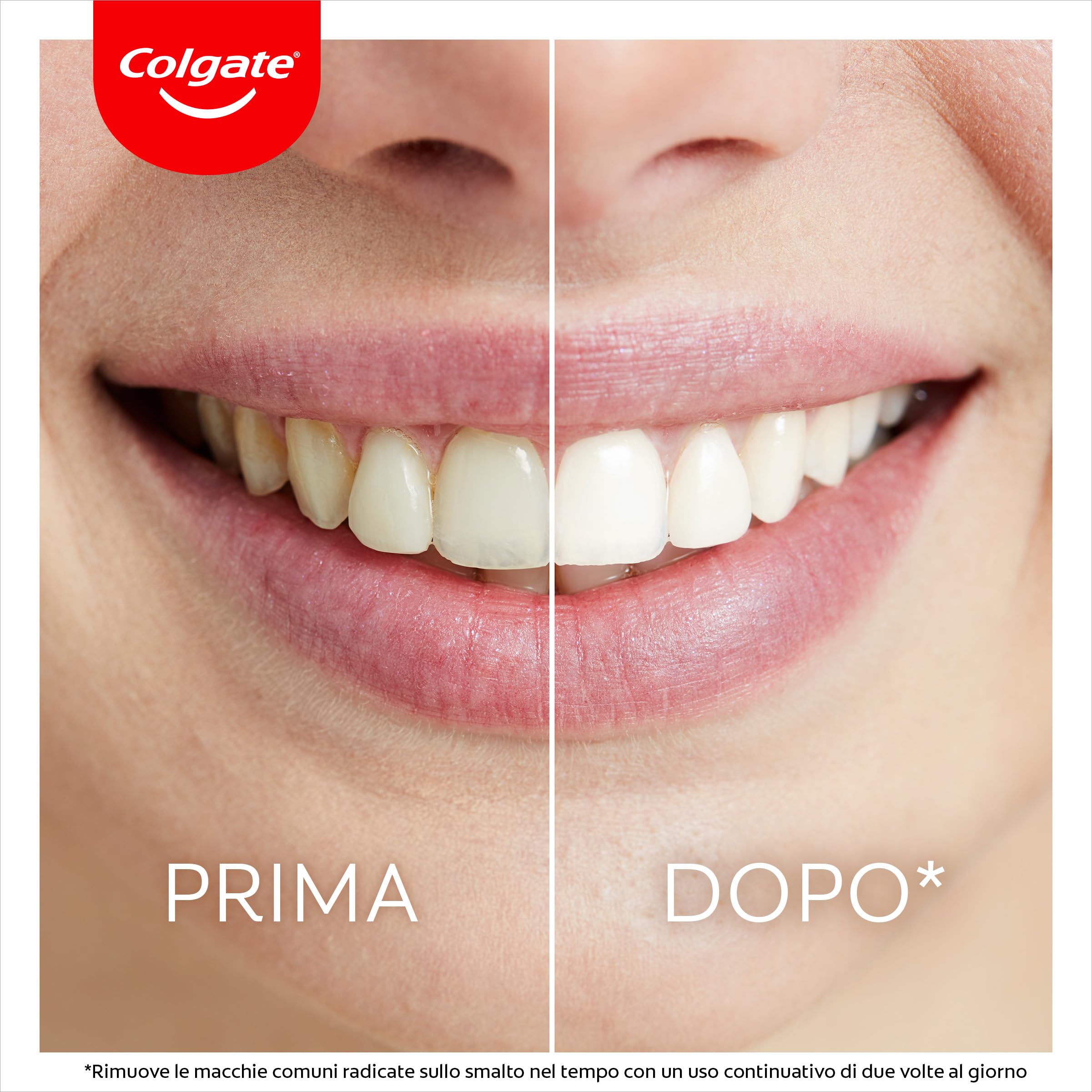 Colgate Max White Ultimate, Kit Sbiancante Denti con Penna Sbiancante Denti + Luce Led sbiancante, Denti Bianchi, Illumina il sorriso in 10 Minuti, Sbiancamento Denti, Sicuro per lo Smalto