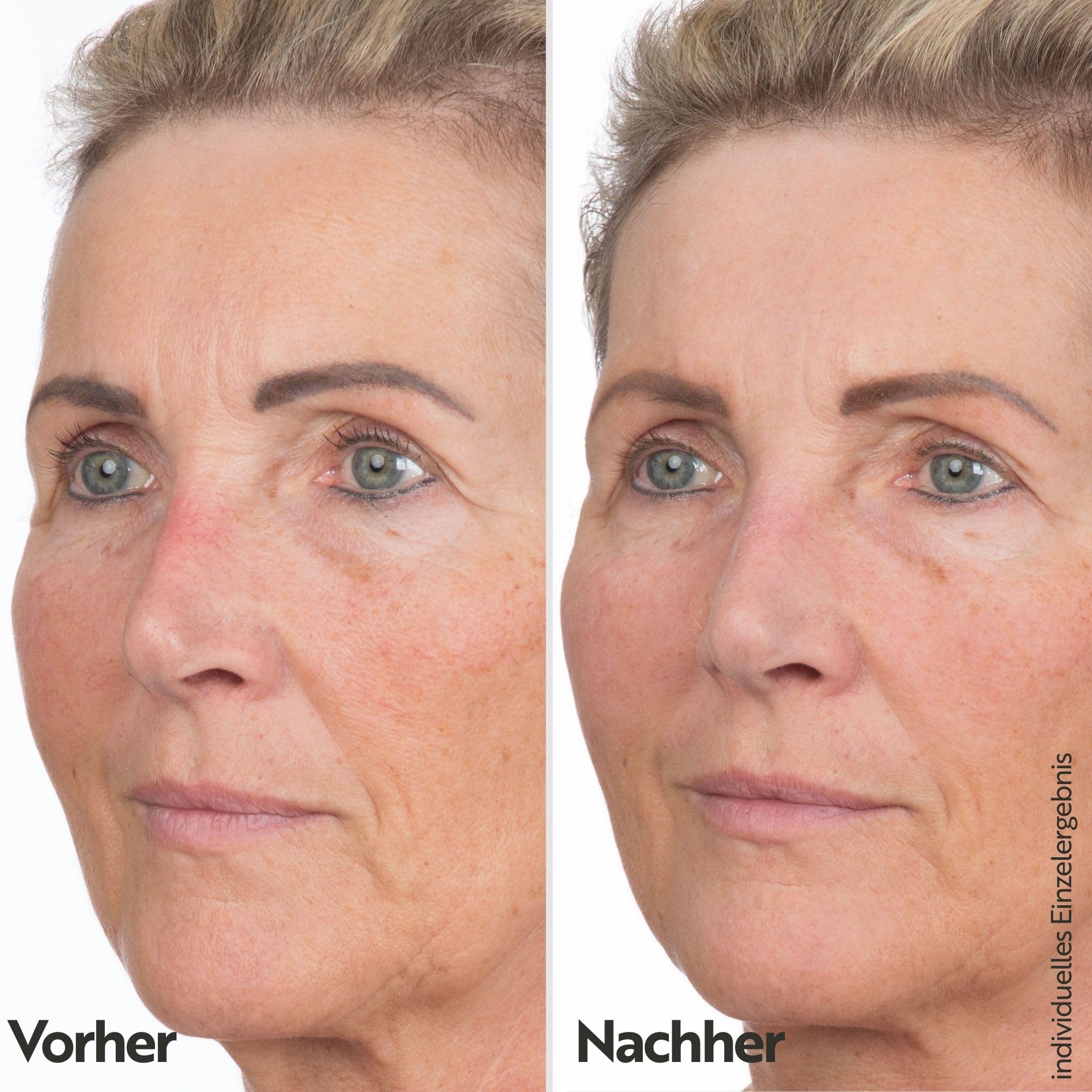M. Asam Vinolift Spezial Nachtpflege (100 ml) | Reichhaltige Nachtcreme zur Regeneration reifer Haut, Anti Falten Creme Mit Hyaluron, Resveratrol und Traubenkernöl