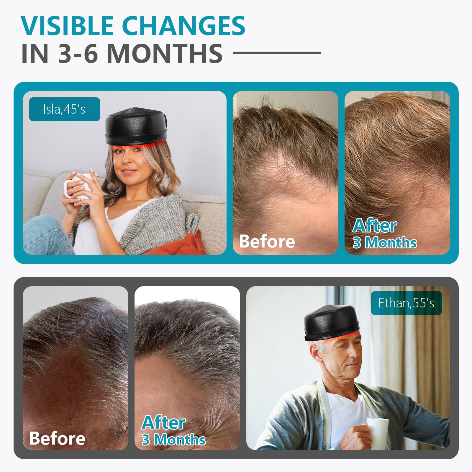 iKeener Red Light Therapy Cap for Hair Regrowth FDA Cleared Wireless Laser Hair Growth Hat with 660nm & 850nm - Image 2