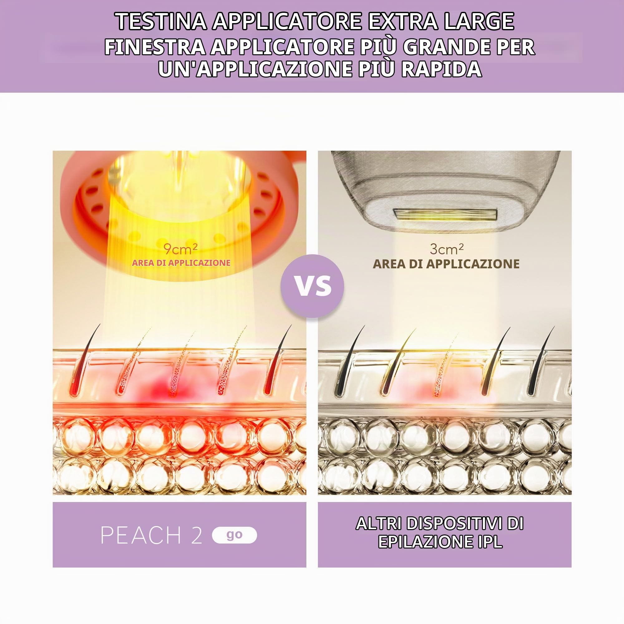 FOREO PEACH 2 Go IPL Da Viaggio + Gel Preparatore Rinfrescante | Epilazione IPL E Laser, IPL Da Viaggio, Raffreddamento Cutaneo, Gel Rinfrescante, Zona Bikini, Peli Del Viso