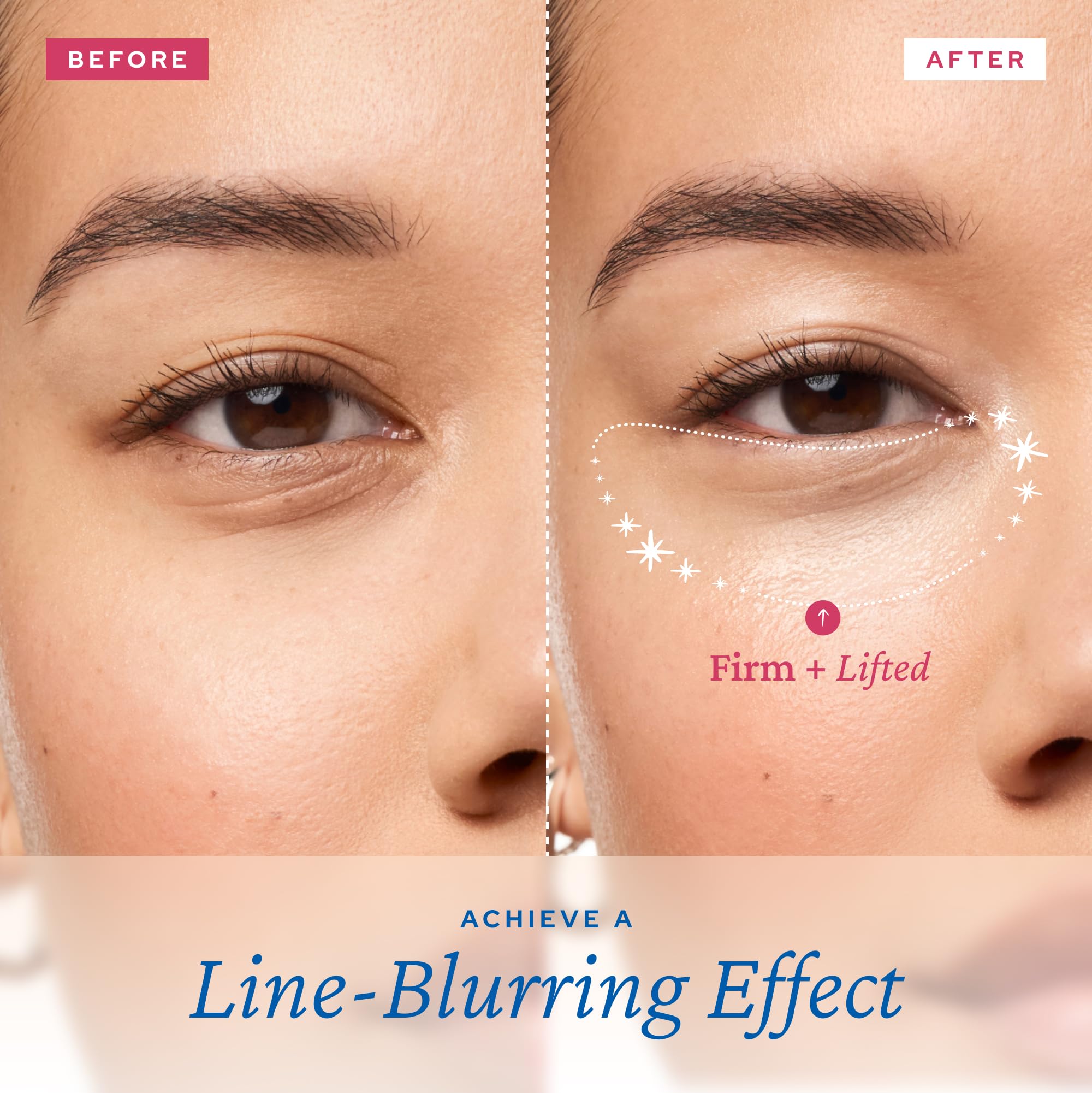 belif Retinol Firming Eye Serum – Aqua Bomb Lifting Eye Gel with Collagen & Bakuchiol for Puffiness, Fine Lines & Wrinkles, Peptide & Hyaluronic Acid, Korean Skin Care