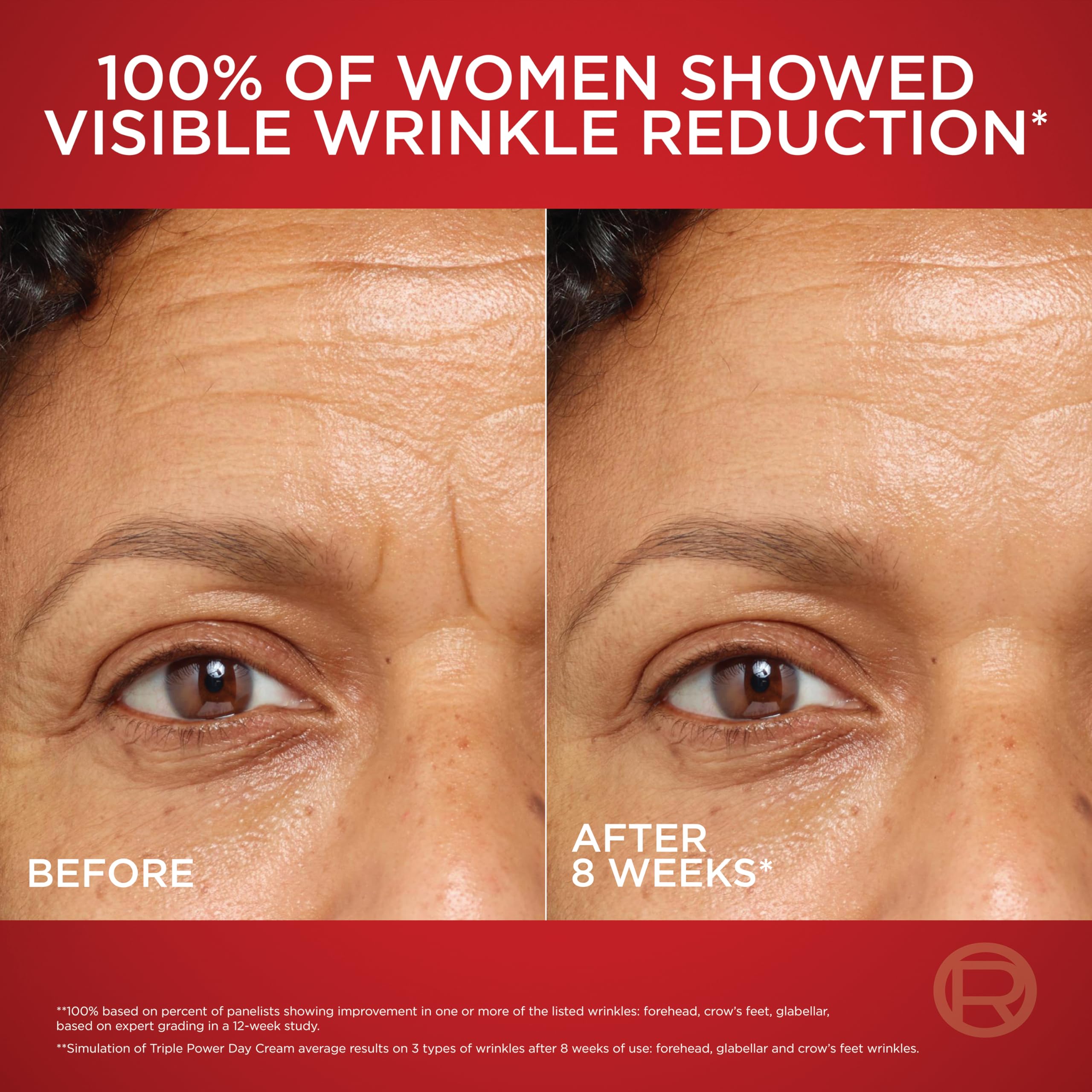 L'Oreal Paris Revitalift Triple Power Anti-Aging Face Moisturizer, Pro Retinol, Hyaluronic Acid & Vitamin C to Reduce Wrinkles, Firm & Brighten Skin, 1.7 Oz: Fragranced 1.7 Ounce (Pack of 1)