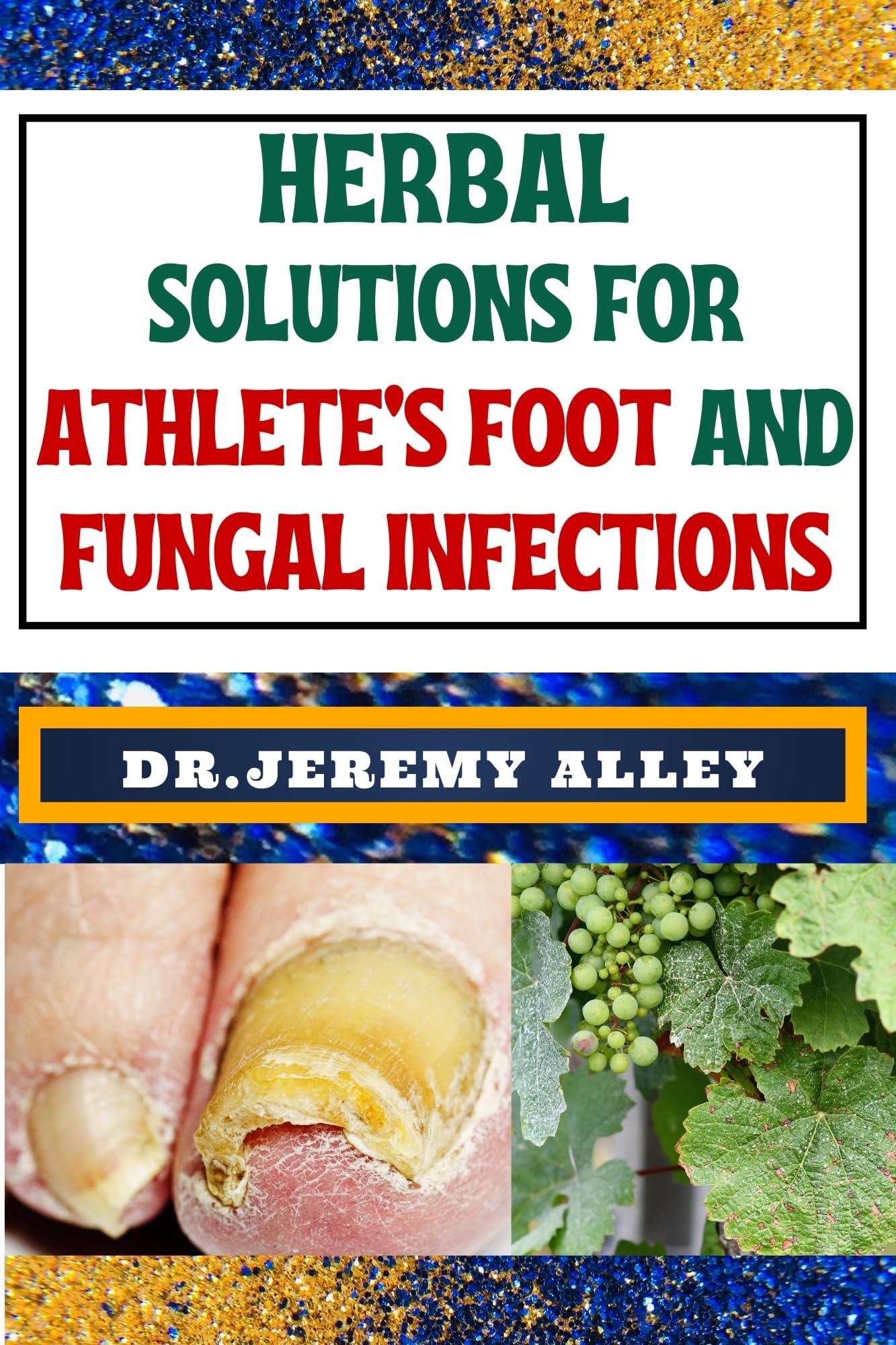 HERBAL SOLUTIONS FOR ATHLETE’S FOOT AND FUNGAL INFECTIONS: Step Into The Healing Garden, Unveiling Herbal Remedies For Naturally Defeat Disease Intruders