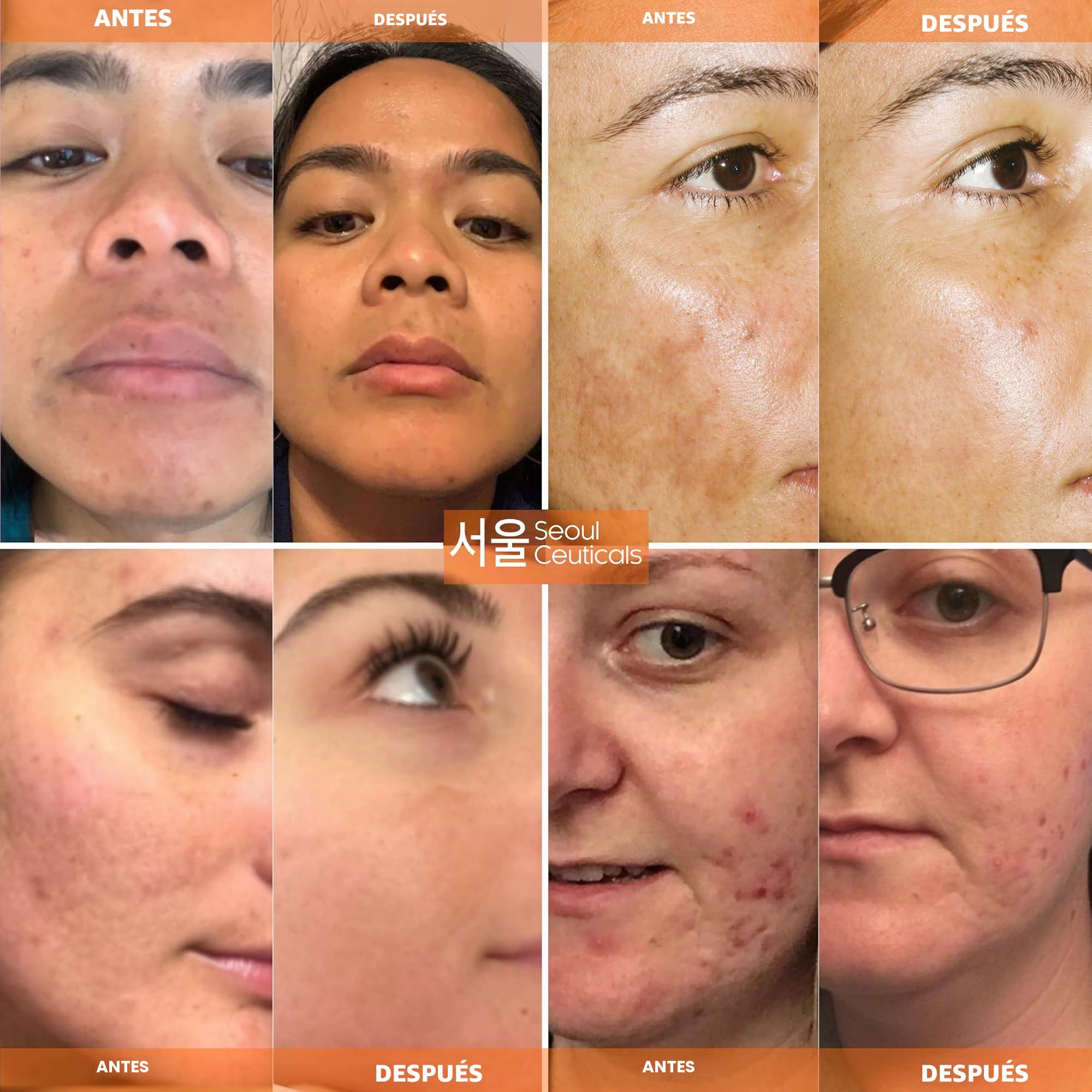 Loción de cuidado de la piel – 20 % Vitamina C E Ferúlico Suero con ácido Hialurónico que proporciona potente antienvejecimiento, resultados antiarrugas, 30 ml