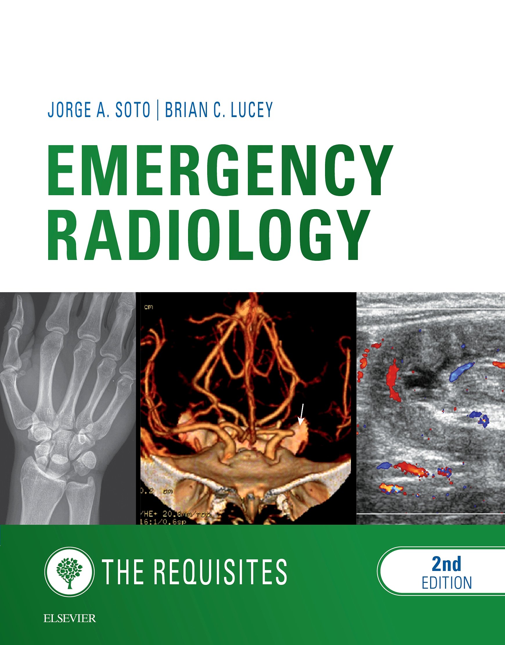 Emergency Radiology: The Requisites E-Book (Requisites in Radiology) (English Edition)