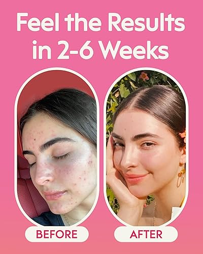 Miniatura 3 de Milamend Equilibrio Hormonal para Mujeres 40:1 Myo-Inositol D-Chiro Inositol Suplemento + CoQ10, ALA y Aminoácidos – Fertilidad, Apoyo Ovarico y