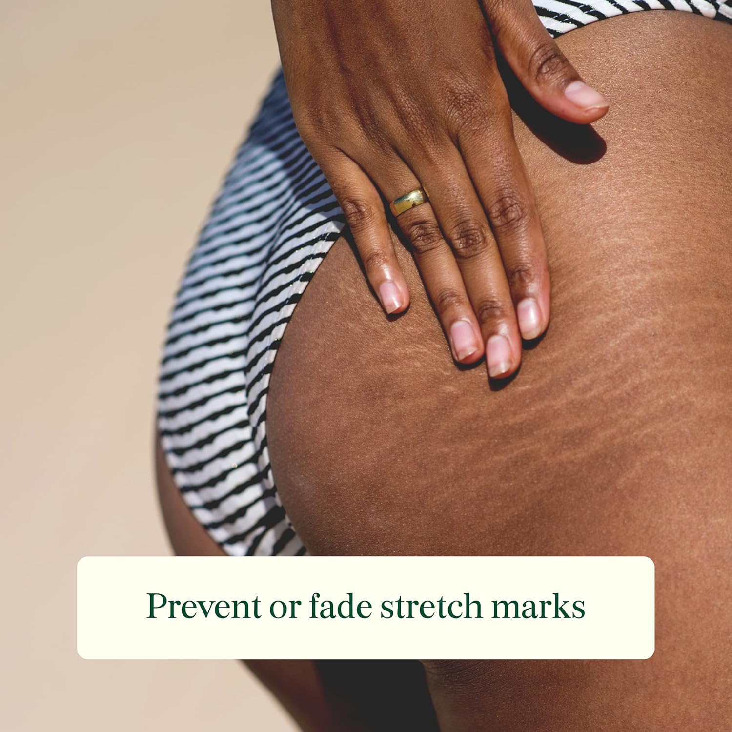 Botanic Tree Cocoa Butter Stretch Mark Cream - Belly Butter Stretch Mark Cream with Shea Butter for Pregnancy and Scar Treatment, Paraben Free, 4 oz. : Everything Else