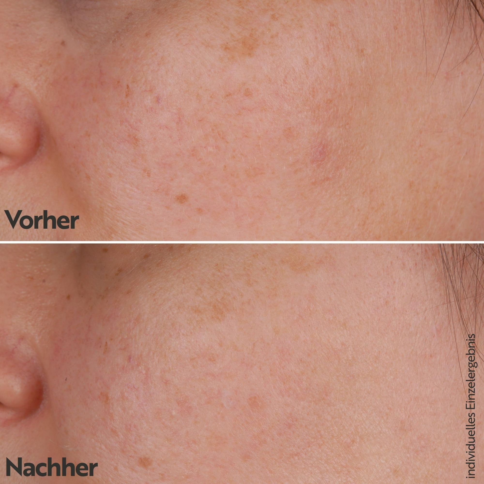 M. Asam Vitamin C Intense 10% Serum (100ml) | Vitamin C Hochdosiert, Anti-Aging Serum Für Strahlenden Glow, Gesichtspflege Für Ebenmäßigen Teint, Spendet Feuchtigkeit