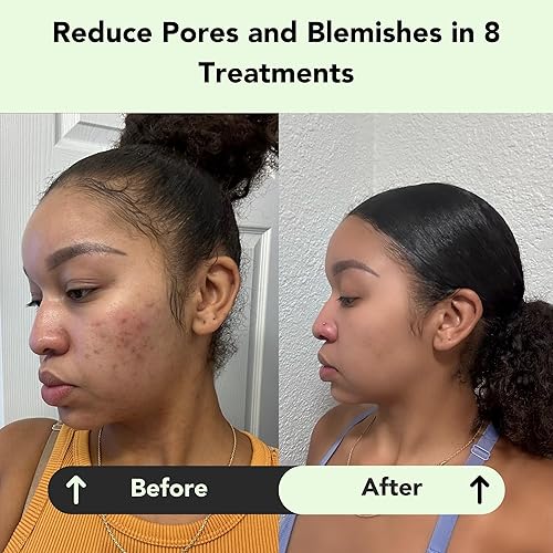 Miniatura 4 de Glorio Kit de descubrimiento de mascarillas de arcilla para tratamiento facial, paquete de 4 (1.6 onzas con aplicador), mascarilla para el cuidado