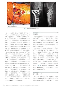 症例から学ぶ 膝周囲骨切り術ピットフォール -陥らないために
