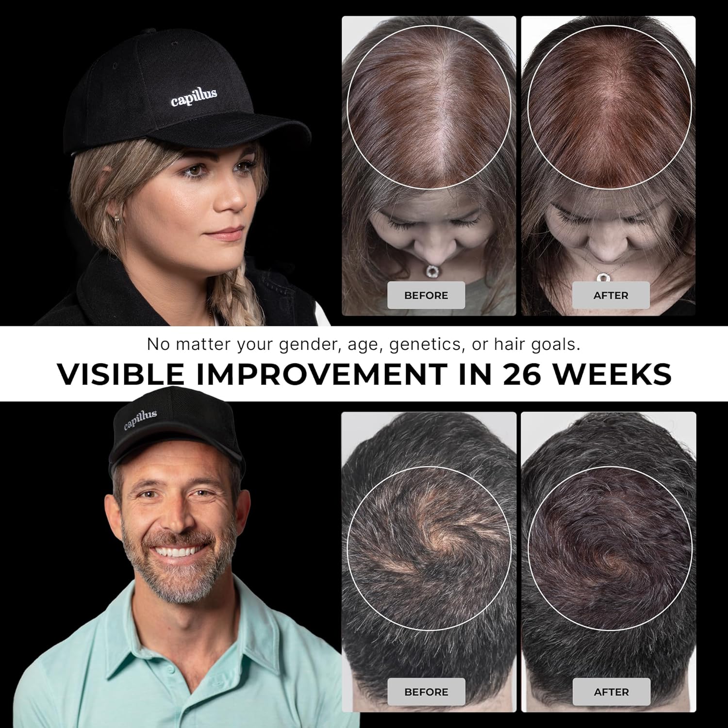 Capillus Pro S2 Red Light Cap For Hair Regrowth,308 Laser Hair Growth Cap, Red Light Therapy Hat, Red Light Cap, Hair Red Light Therapy For Hair Growth, LLLT +Bluetooth Battery - Image 2