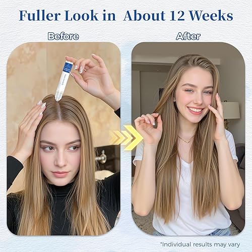 Miniatura 5 de Suero para el crecimiento del cabello roll-on de 0.8 onzas líquidas con palma enana, romero y extracto de guisante, ayuda a apoyar la apariencia del