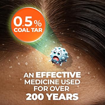 Medicasp Anti-Dandruff Shampoo and Massager Kit Coal Tar for Dandruff, Psoriasis, and Seborrheic Dermatitis, Scalp Massager Brush for Exfoliation and Care, 6 fl oz