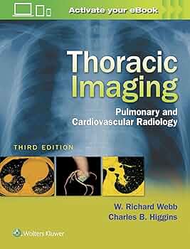 胸部の画像診断 Thoracic Imaging 2023.03.10 胸部X線画像病変検出ソフトウェア（CXR-AID）導入の