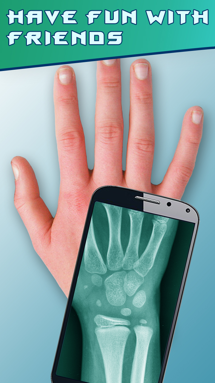 Amazing XRayAmazon.co.jpAppstore for Android