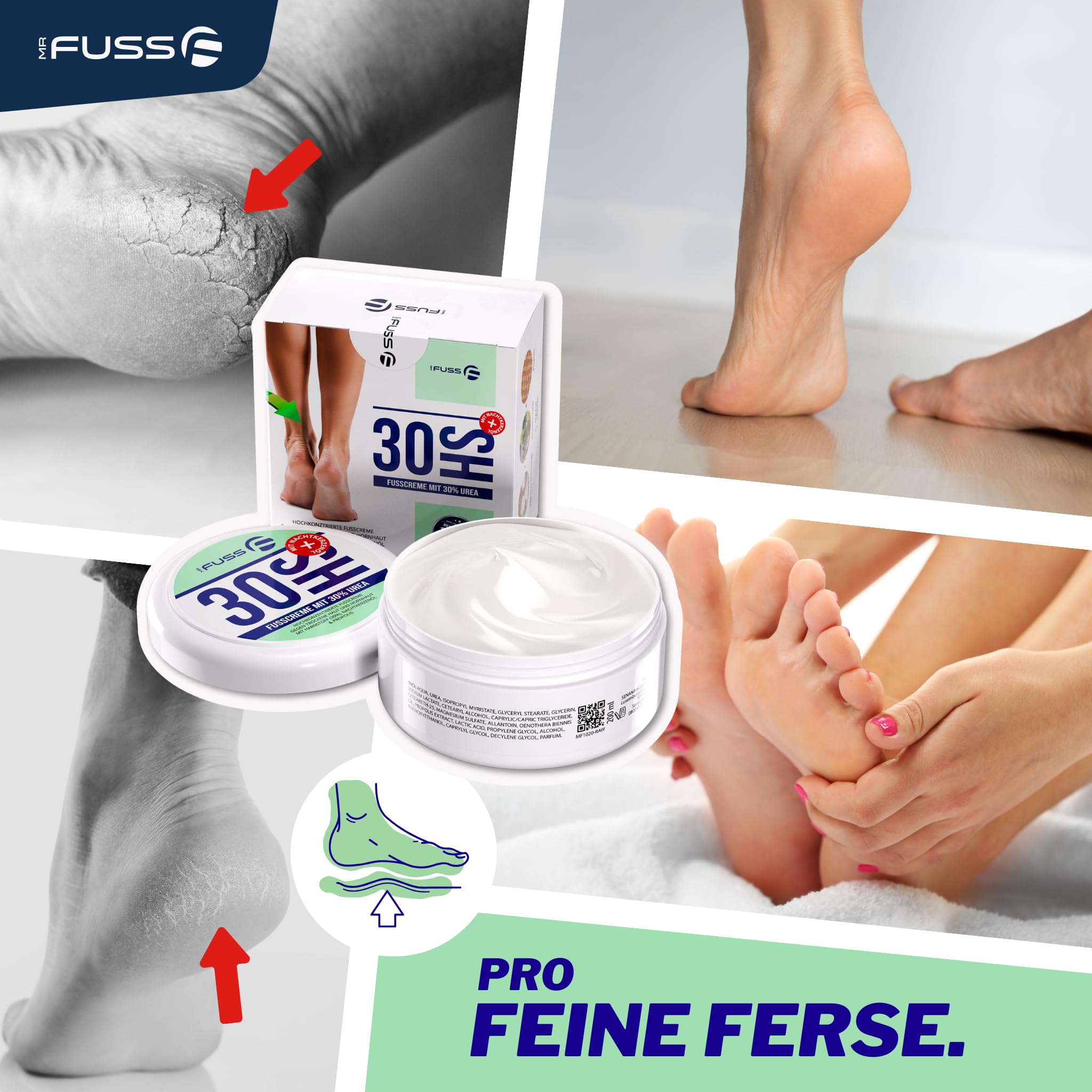 Mr. Fuss Krem do usuwania rogowacenia z mocznikiem 30% | Krem do stóp do usuwania rogowacenia | Pielęgnacja skóry stóp | Maść do popękanych pięt stóp | Z olejem z nagietka, gliceryną i propolisem