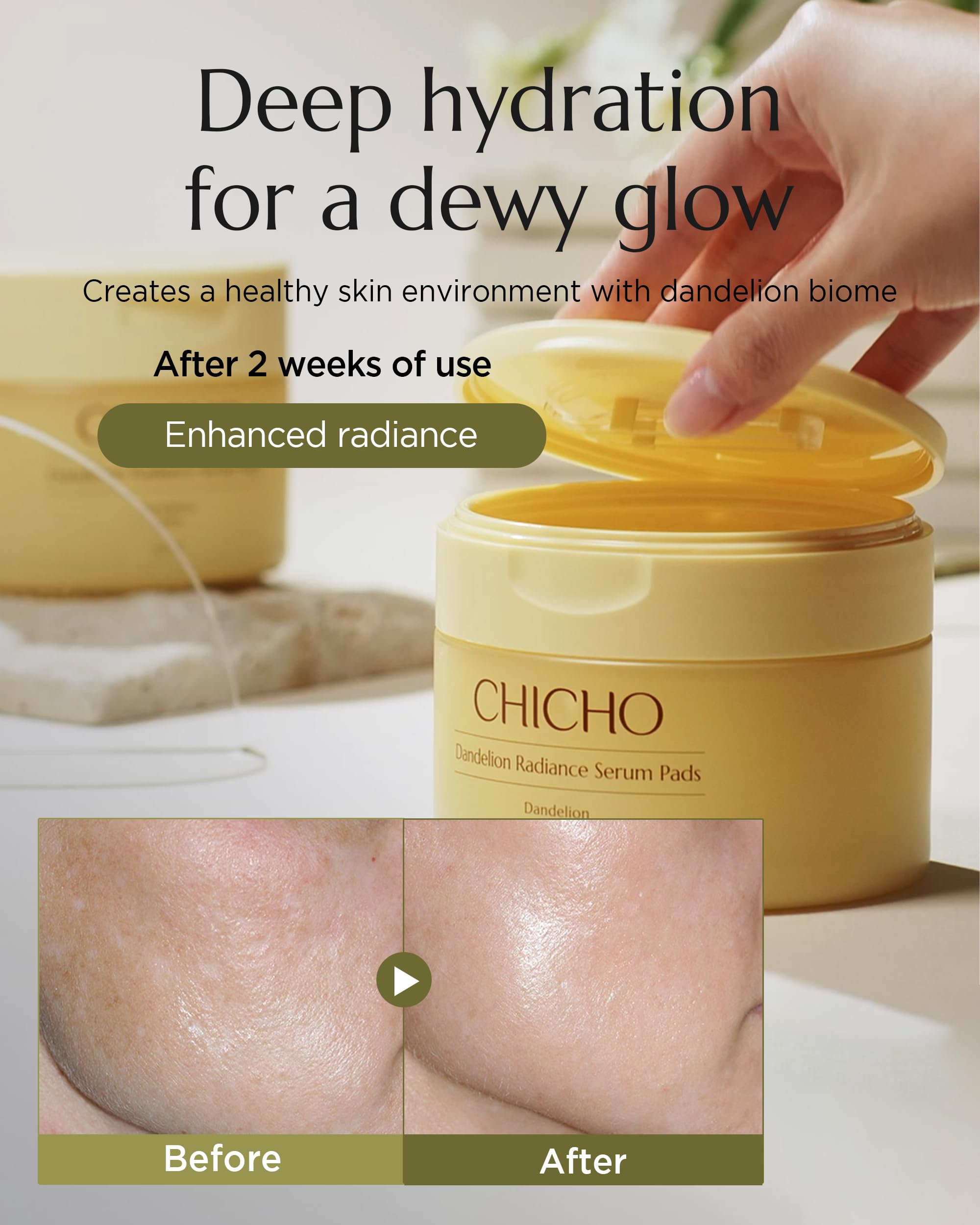 CHICHO Dandelion Radiance Serum Pads (90 Pads) - Jumbo 8cm Quick Mask Toner Pads - 80,2% Löwenzahn Biom + Lotus, Vegan pH 5.2, Empfindliche Haut