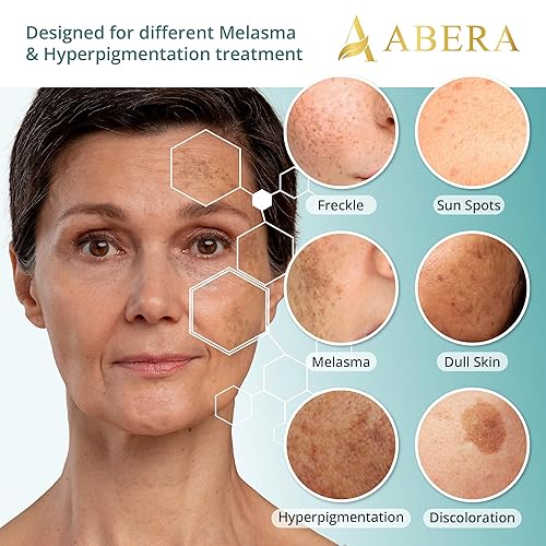 Miniatura 4 de Abera Tratamiento de melasma para cara, removedor de manchas oscuras de melasma, suero corrector de manchas oscuras con juego de 5 máscaras para