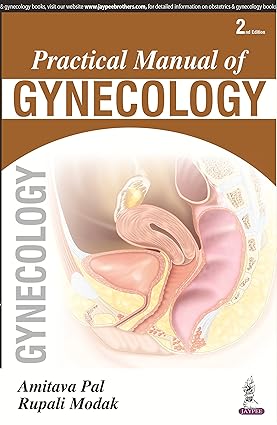 PRACTICAL MANUAL OF GYNECOLOGY