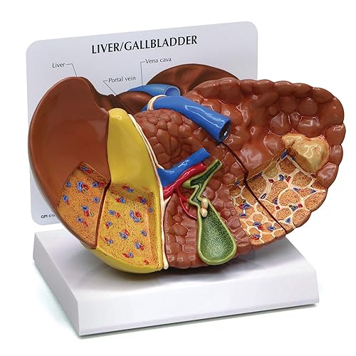 GPI Anatomicals - Modelo hepático con patologías comunes, réplica para la educación en anatomía y fisiología humana, modelo de anatomía para