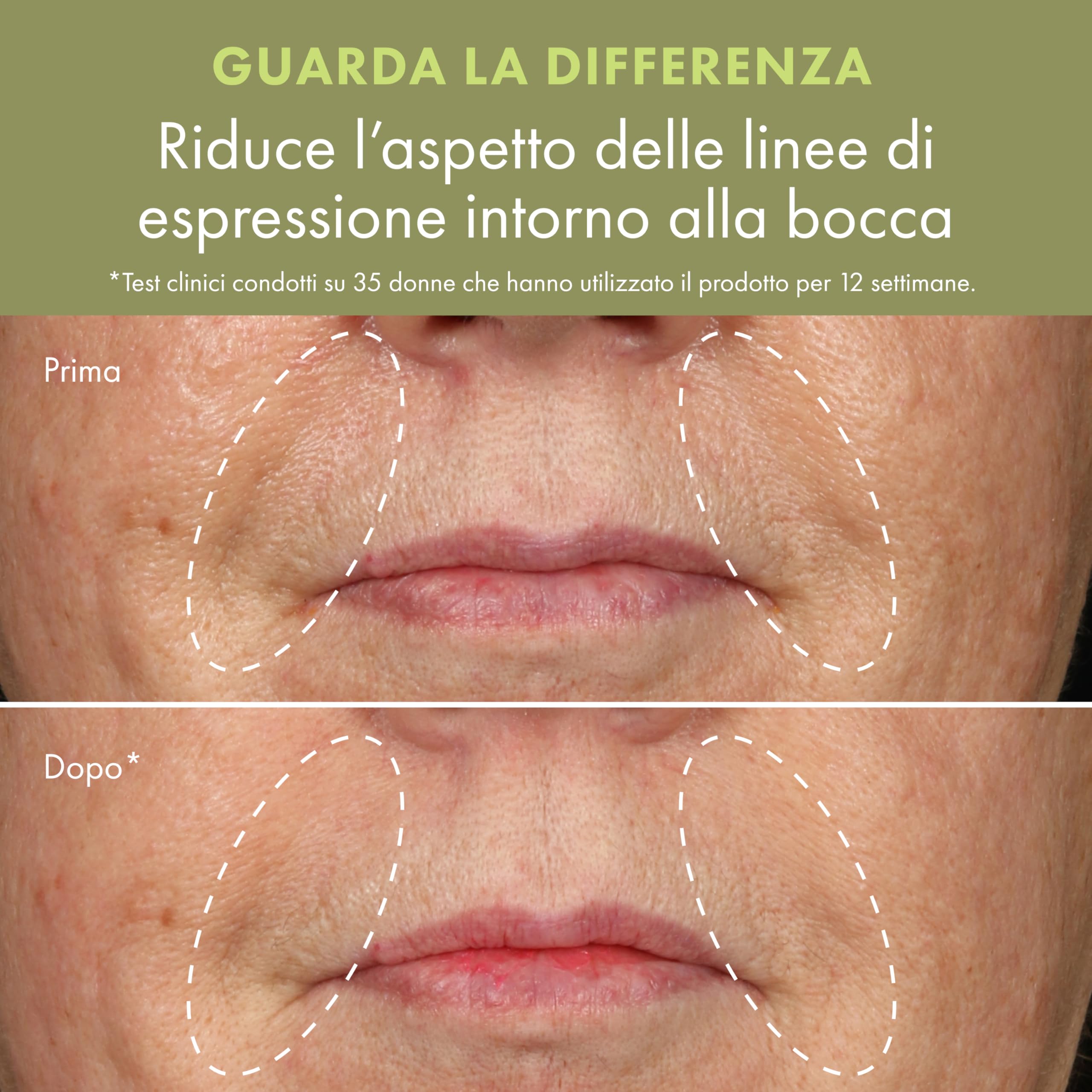 Origins Plantscription Anti-Aging Serum with Retinoid | Siero Anti-Età che Riduce le rughe più profonde - Con Retinoidi e Peptidi