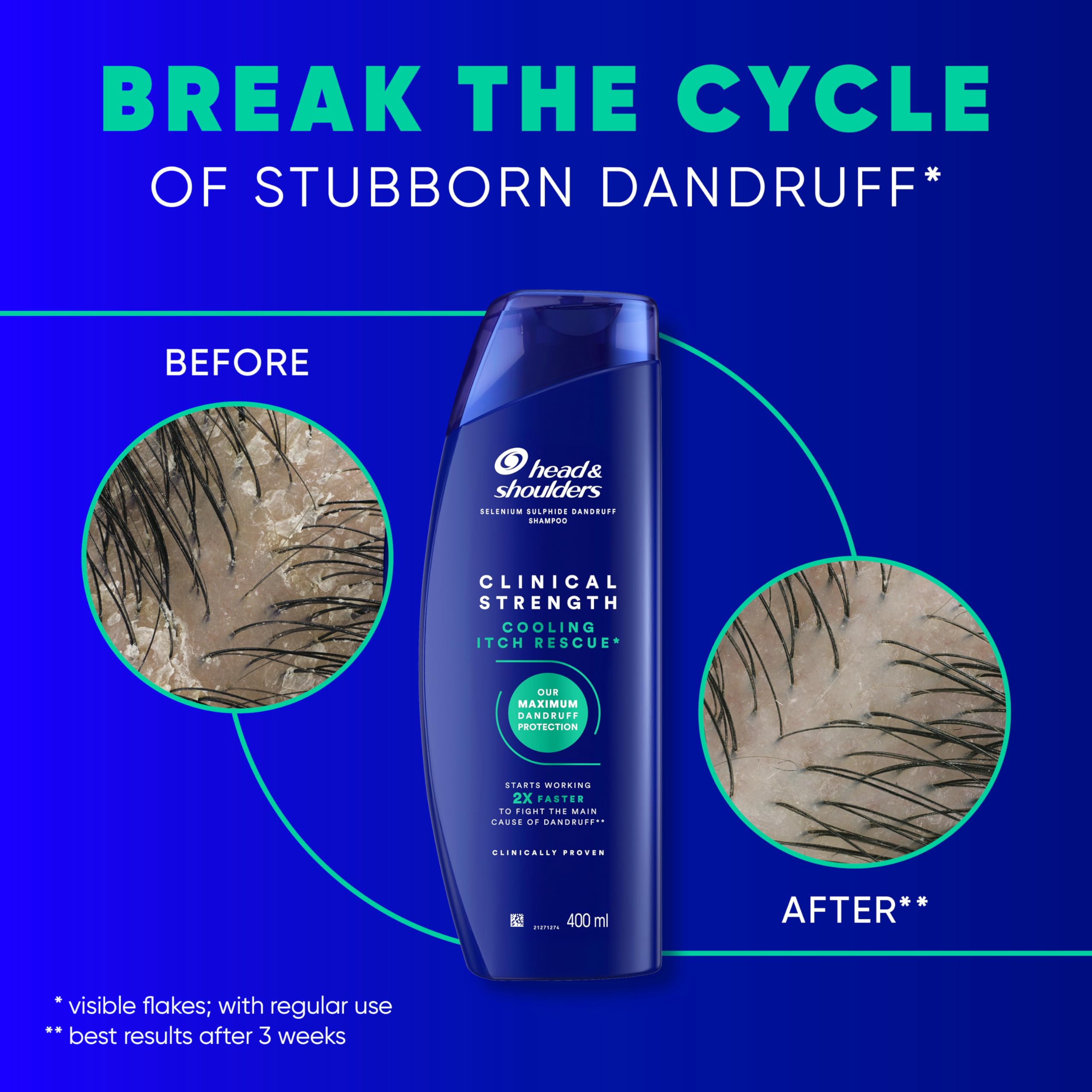 Head & Shoulders Cooling Itch Rescue 400ml Selenium Sulphide Anti-Dandruff Shampoo, Clinical Strength - Image 3