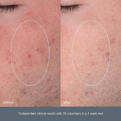 Miniatura 5 de Dermalogica Microfoliante diario - Exfoliante facial en polvo - Logra una piel más brillante y suave diariamente con enzima de papaya y ácido