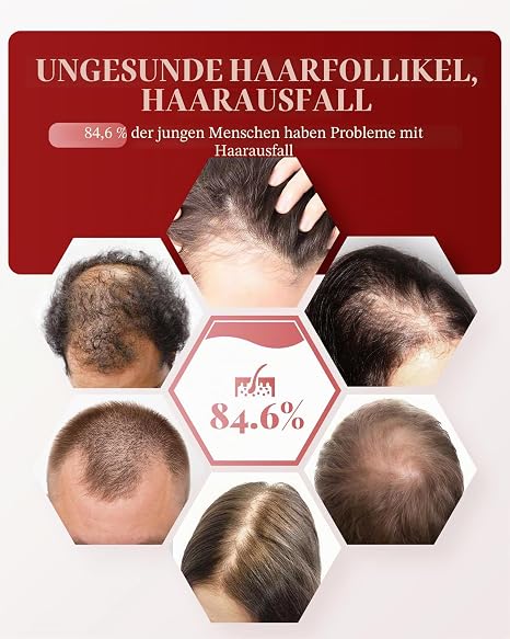 KTS Red Light Hair Growth Comb 660nm & 650nm Red Light Dual Light Spectrum for Scalp Care Hair Loss Treatment for Women/Men Restores Hair Thickness Volume Hair Growth Accelerate