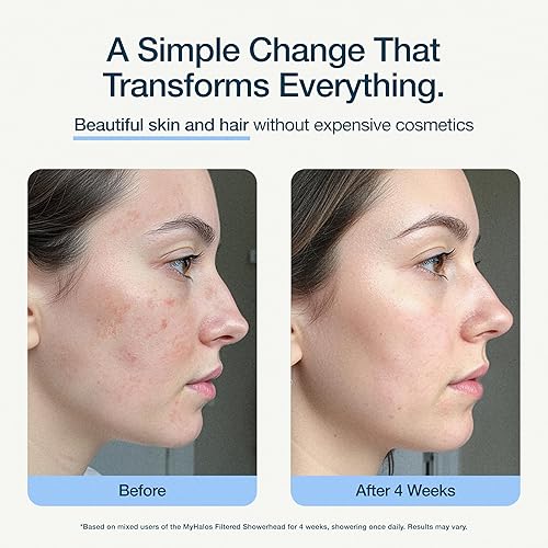Miniatura 6 de MyHalos Cabezal de ducha filtrado para filtro de agua dura, alta presión, elimina el cloro, filtro de cabezal de ducha para suavizador de agua dura,