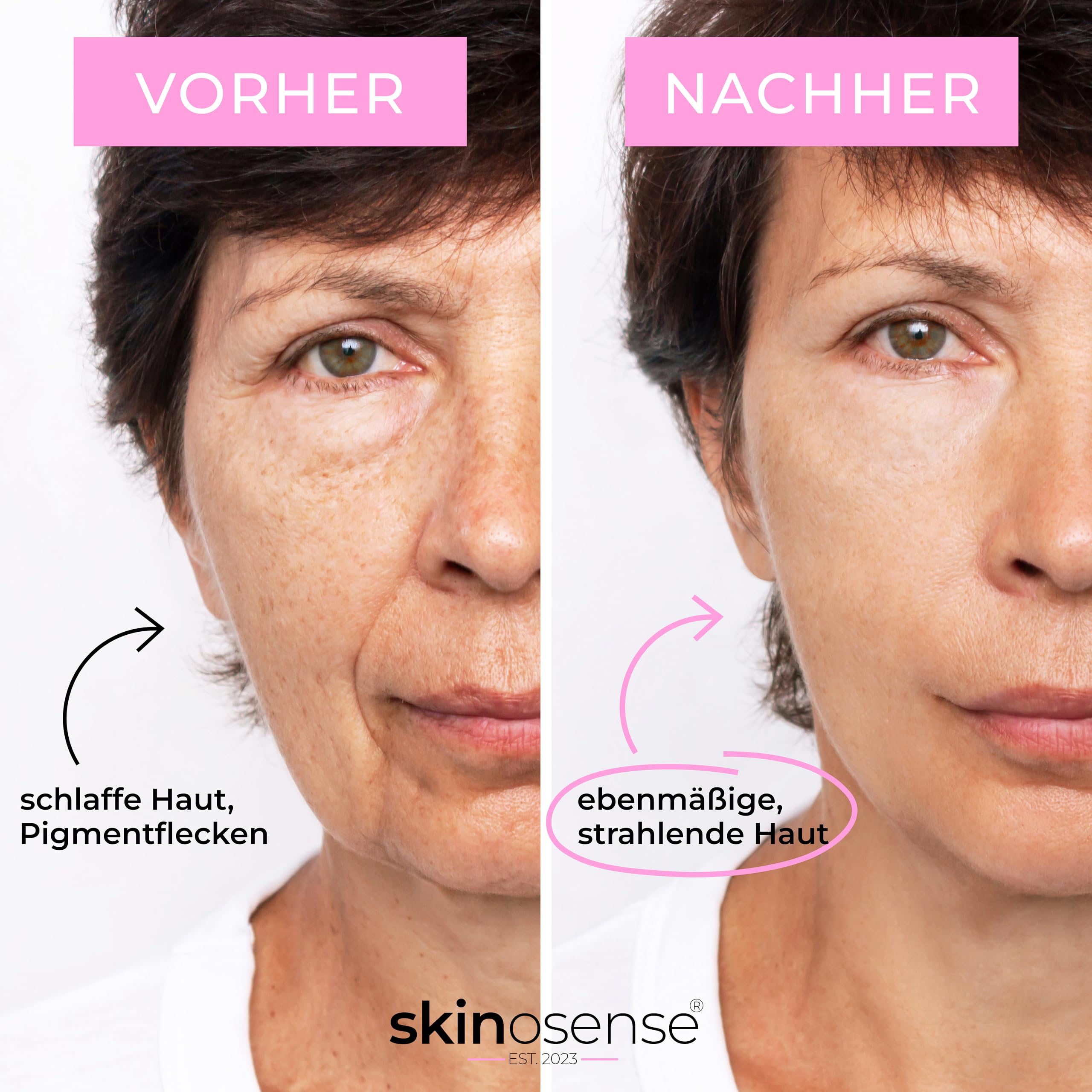 Microneedling Beauty Pflege Premium Set | Dermaroller für Strahlende Haut – Anti-Aging Beauty Tool – Porenverfeinerung & Hautstraffung – Premium Gesichtspflege