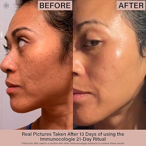 Miniatura 4 de IMMUNOCOLOGIE Vital Ionic Mist - Spray facial hidratante, purificante y refrescante con agua de arcilla verde francesa para calmar el enrojecimiento