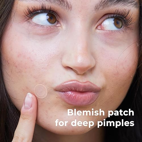 Miniatura 2 de OMMA Micropoint - Parche para acné quístico  Parches eficientes para espinillas con microagujas, parches de manchas oscuras para granos dolorosos en
