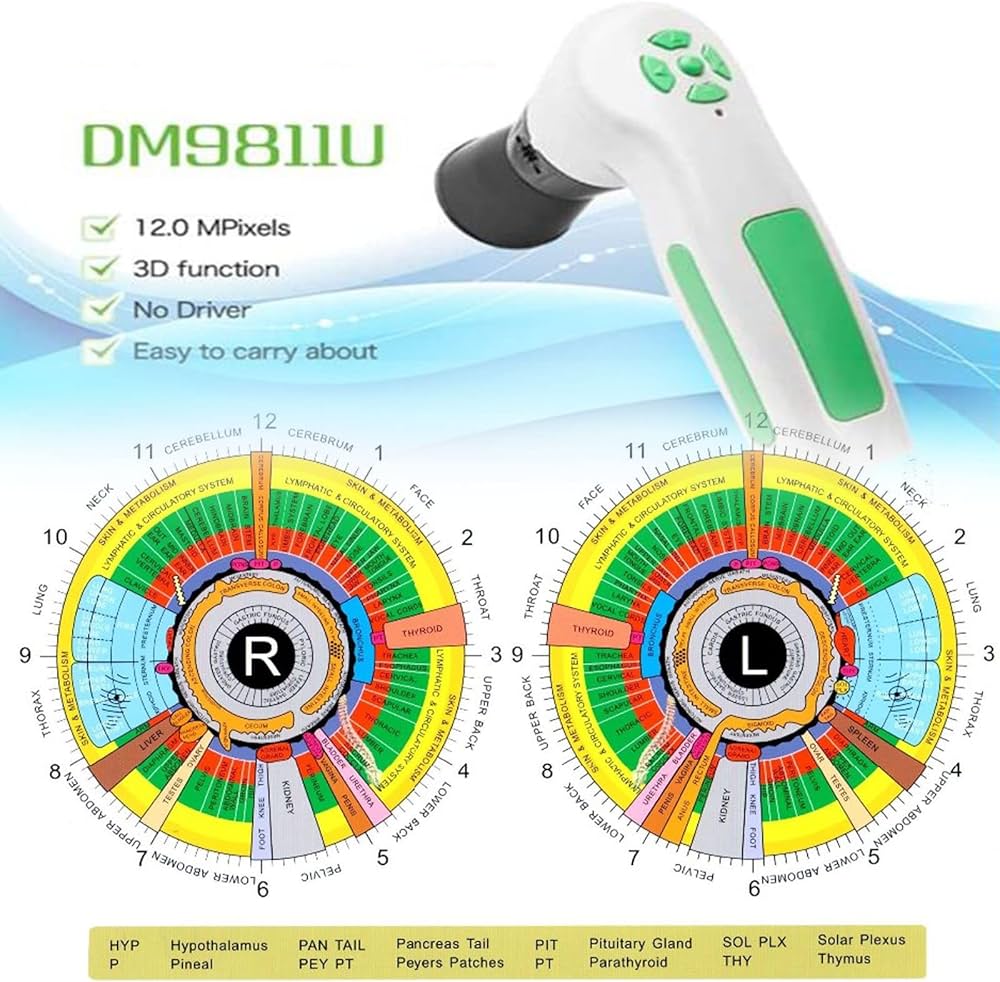 Amazon.co.jp: IRIS Analyzer IRIS検出器HD 1200万USB2.0