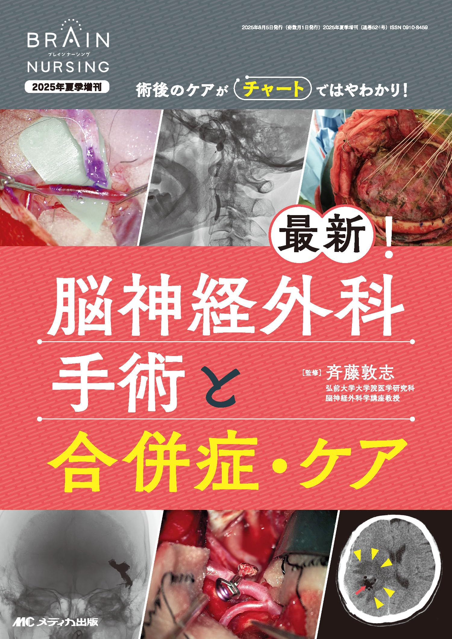 りん様用　脳神経外科書籍3 りん様用 脳神経外科書籍3 m3電子書籍 | 【後期研修医】脳神経外科