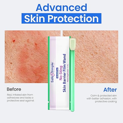 Miniatura 7 de Safe n' Simple Varita de barrera para la piel, 25 varitas empaquetadas individualmente, aplicador sin picaduras, hisopo estéril para ostomía,