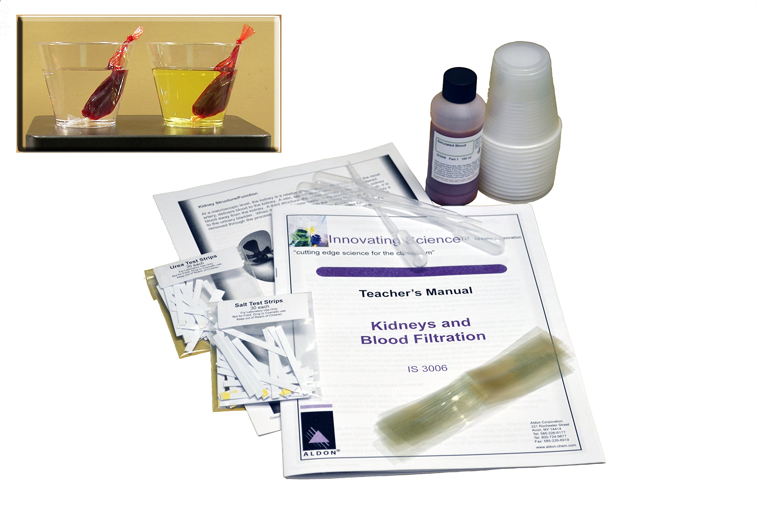 ALDON Innovating Science - Kidneys and Blood Filtration Kit