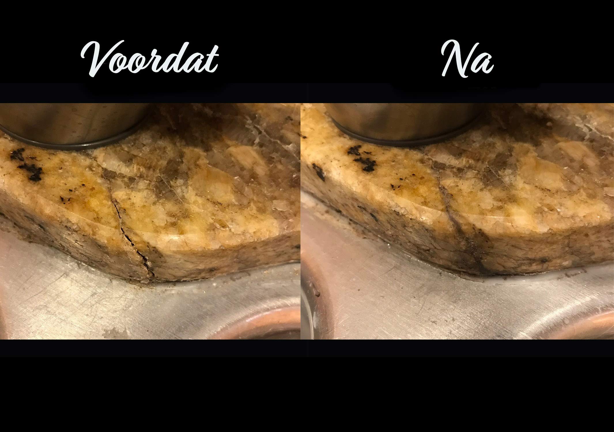 HIMG Lca(Tm) Clear, Light Cure Acrylic Diy Surface Repair Kit For