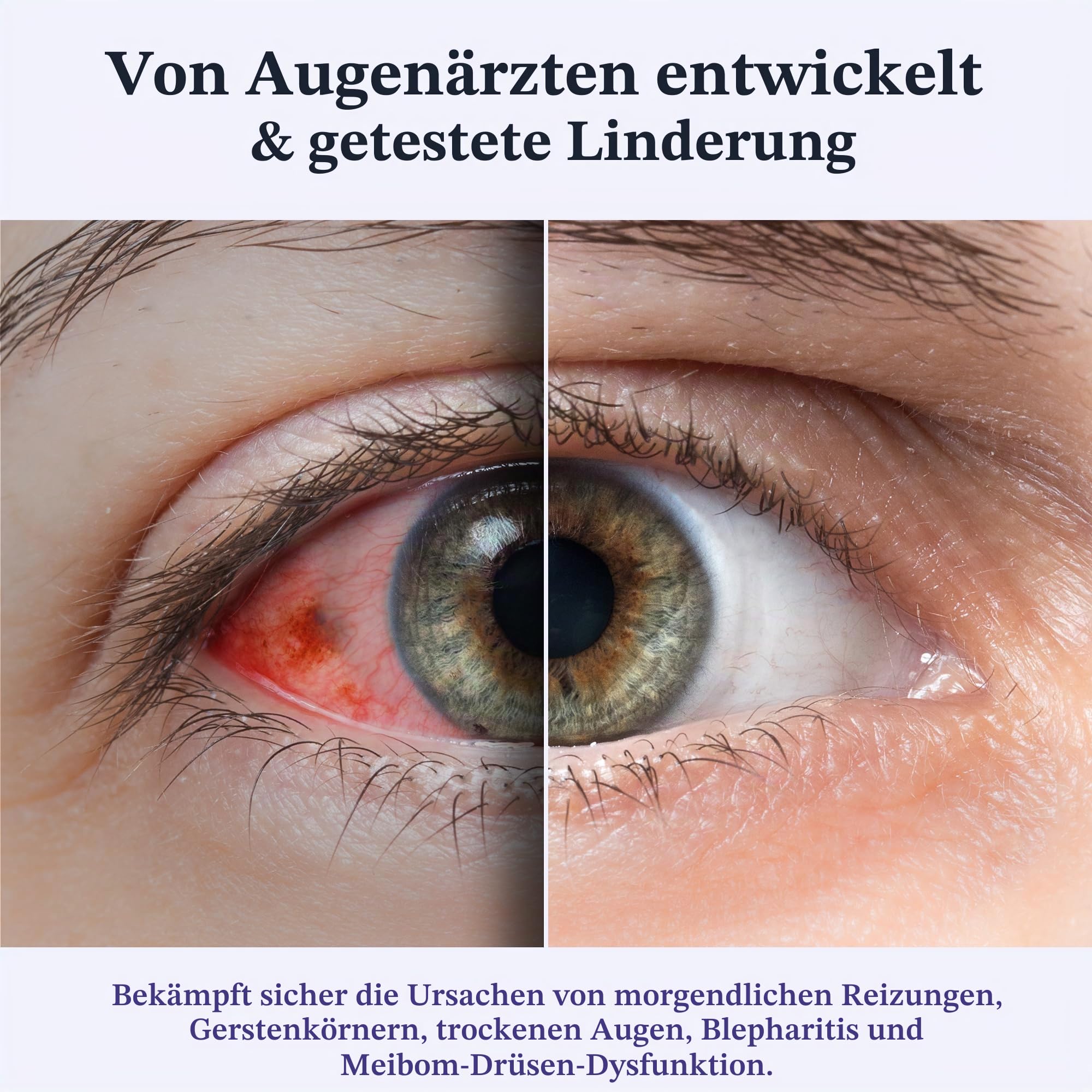 CorneaCare Ruhe: Selbsterwärmende warme Kompresse für trockene Augen, beheizte Augenmaske für schnelle Linderung, Dampfmaske zur Stilbehandlung, keine Mikrowelle oder Waschlappen erforderlich