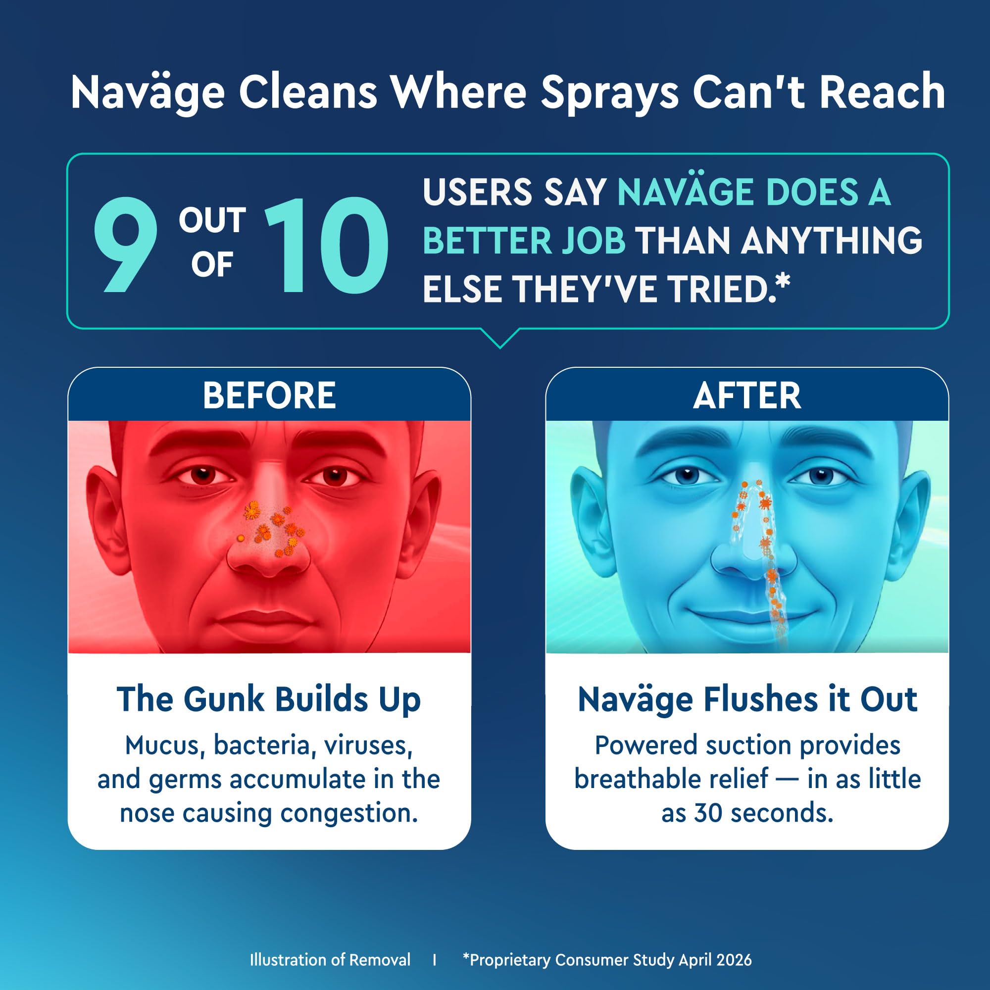 Navage Advanced Nose Cleaner - Powered Suction Nasal Irrigation System — Amazon image 5