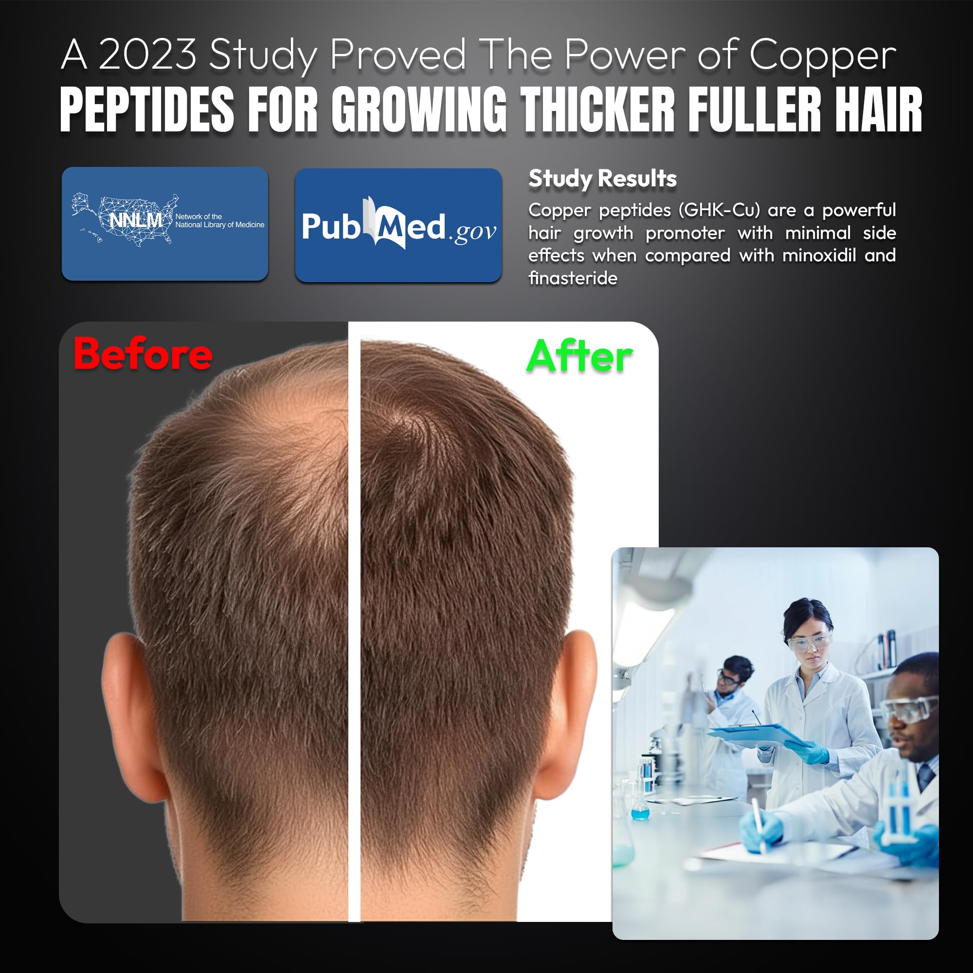 ghk cu hair growth side effects Truth Guy GHK-CU Anti-Aging Copper Peptide Serum for Skin & Growth, with Carbon stack:muscle-growth