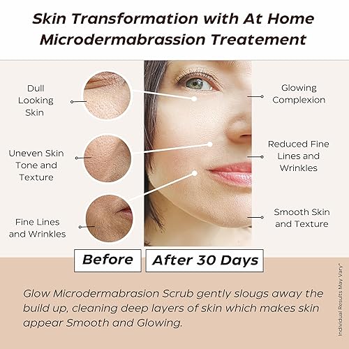 Miniatura 2 de Esmalte de microdermoabrasión resplandeciente: antienvejecimiento (vitamina C natural, ácido salicílico, enzimas, AHA) exfolia profundamente la piel