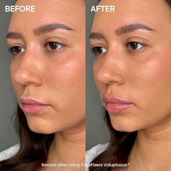 Transformulas Facefixers Voluptuous LipVolume Instant Plumping Lip Serum, Hydrating, Sculpts & Smooths Lips, Clinically Proven, Non-Sticky, Fullness Boost Cruelty Free & Dermatologically Tested 3ml
