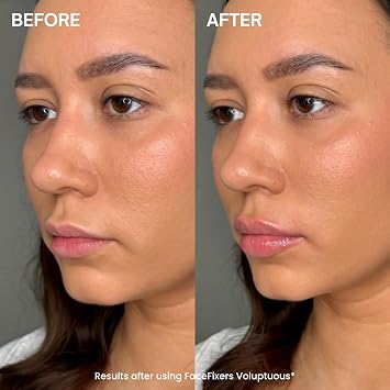 Transformulas Facefixers Voluptuous LipVolume Instant Plumping Lip Serum, Hydrating, Sculpts & Smooths Lips, Clinically Proven, Non-Sticky, Fullness Boost Cruelty Free & Dermatologically Tested 3ml